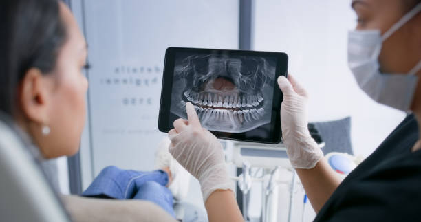 Licensed Wisdom Tooth Removal service in Tomball, TX - Smile Center Dentistry